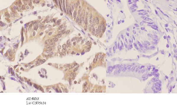 a01475t421 rps6kb1 primary antiboties ihc testing 3