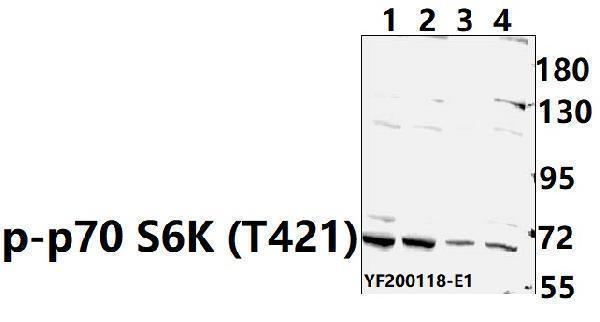 a01475t421 rps6kb1 primary antiboties wb testing 1