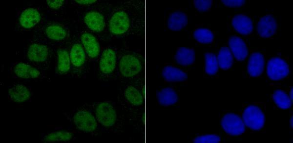 ICC staining hnRNP A1 in MCF-7 cells (green)