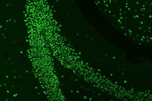 a01476 hnrnpa1 primary antibodies if testing 8