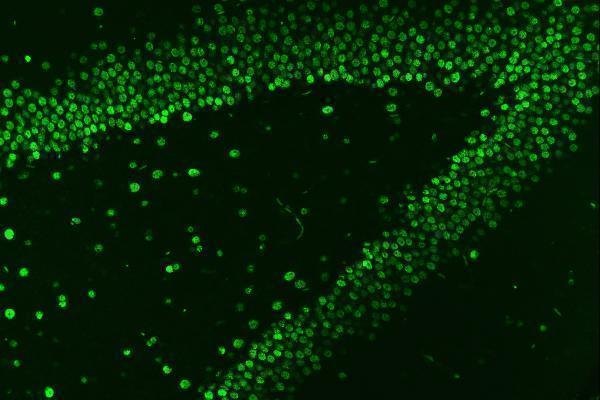 a01476 hnrnpa1 primary antibodies if testing 9
