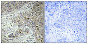 a01477 1 ttf1 primary antibodies ihc testing 1