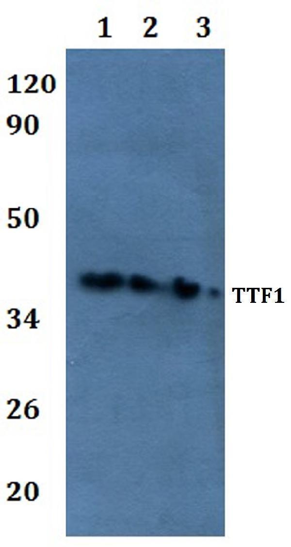 Western blot (WB) analysis of TTF1 polyclonal antibody at 1:500 
Line1:HEK293T whole cell lysate
Line2:H9C2 whole cell lysate
Line3:Raw264