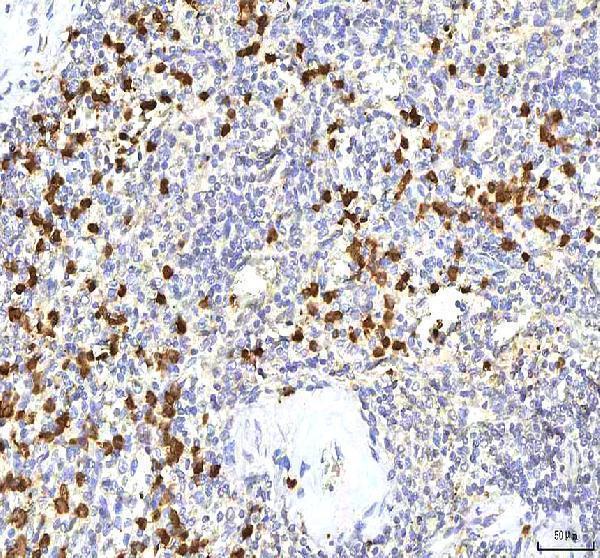  IHC analysis of S100A12 using anti-S100A12 antibody (A01478-1)
