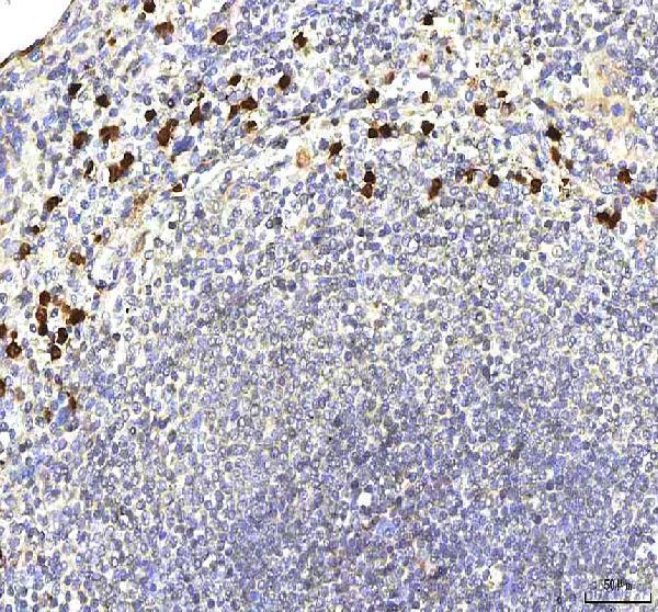  IHC analysis of S100A12 using anti-S100A12 antibody (A01478-1)