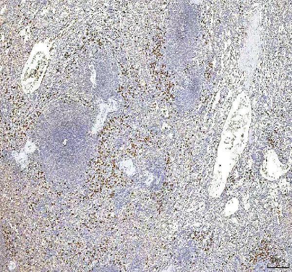  IHC analysis of S100A12 using anti-S100A12 antibody (A01478-1)