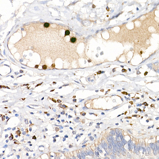 a01478 s100a12 primary antiboties ihc testing 4