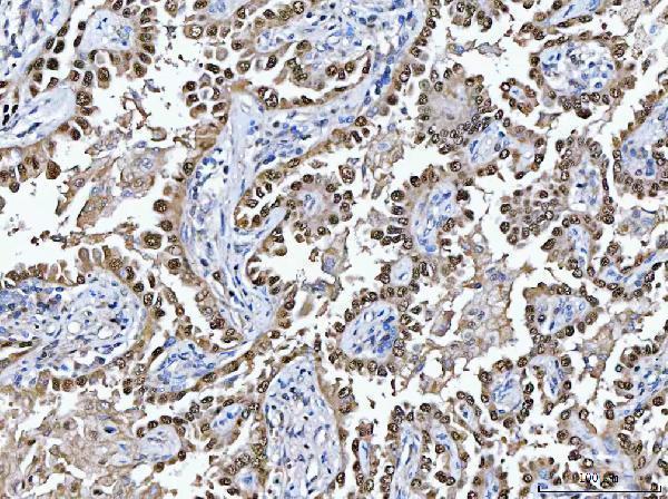 a01479 1 gsr primary antibodies ihc testing 2