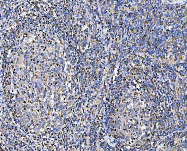 a01479 1 gsr primary antibodies ihc testing 3