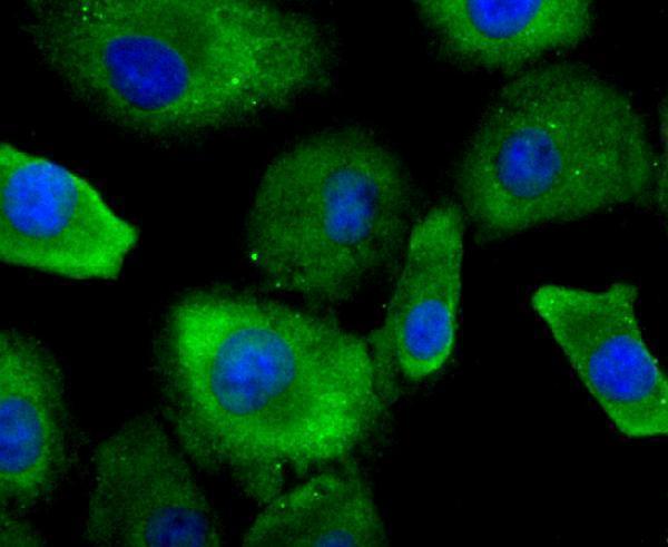 ICC staining Profilin 1 in A549 cells (green)