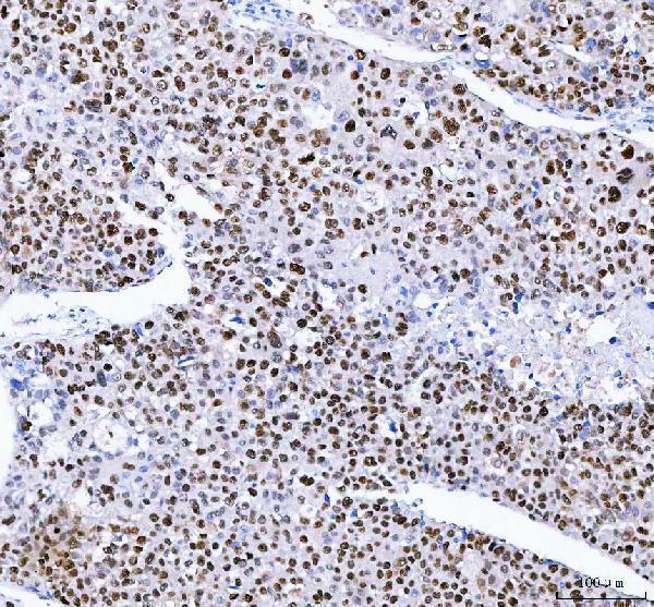  IHC analysis of FEN1 using anti-FEN1 antibody (A01484-1)