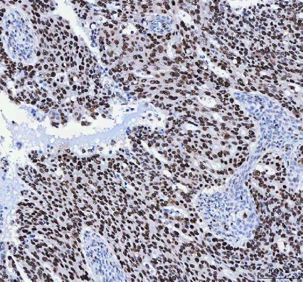  IHC analysis of FEN1 using anti-FEN1 antibody (A01484-1)