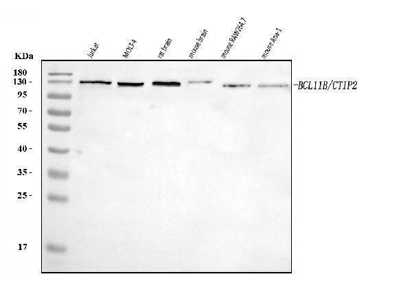  Western blot analysis of Ctip2/BCL11B using anti-Ctip2/BCL11B antibody (A01485-1)