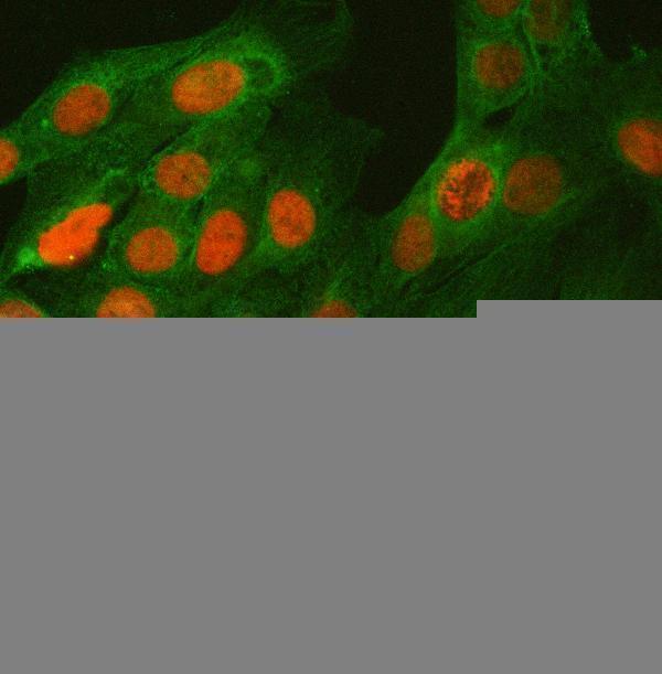 a01485 2 bcl11b primary antibodies if testing 10