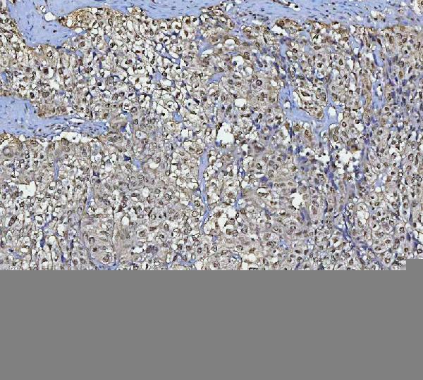  IHC analysis of BCL11B using anti-BCL11B antibody (A01485-2)