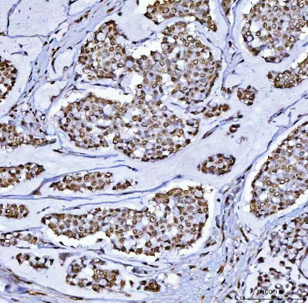  IHC analysis of BCL11B using anti-BCL11B antibody (A01485-2)