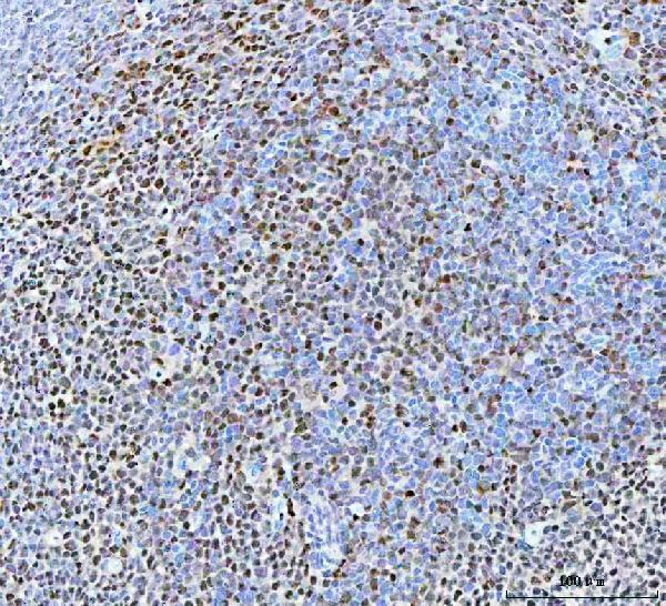 a01485 2 bcl11b primary antibodies ihc testing 4
