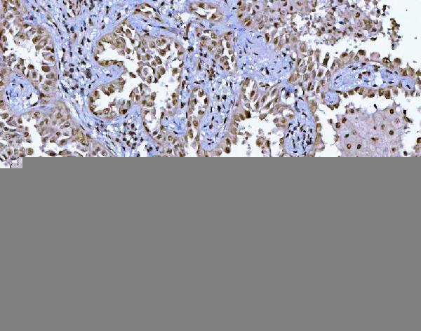 a01485 2 bcl11b primary antibodies ihc testing 5