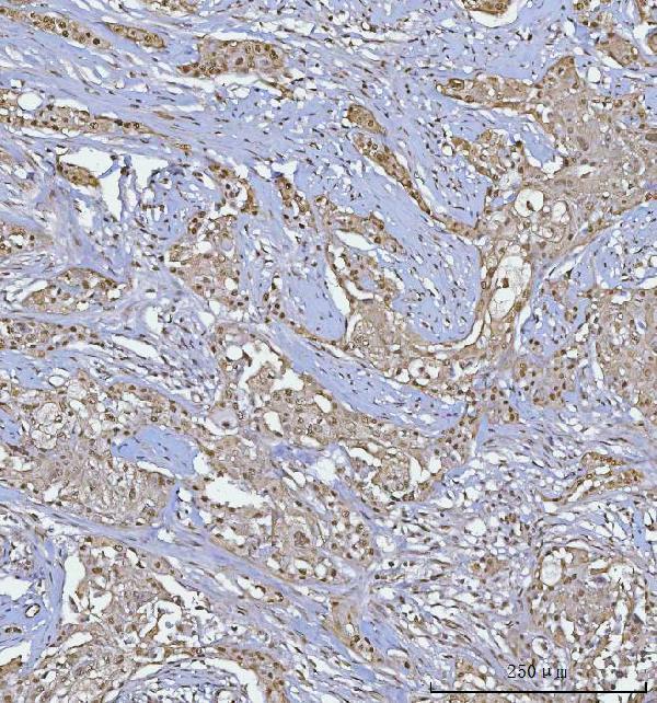 a01485 2 bcl11b primary antibodies ihc testing 6