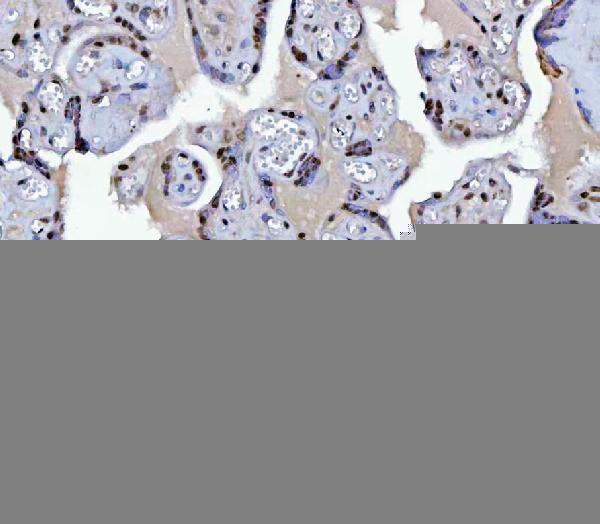 a01485 2 bcl11b primary antibodies ihc testing 7