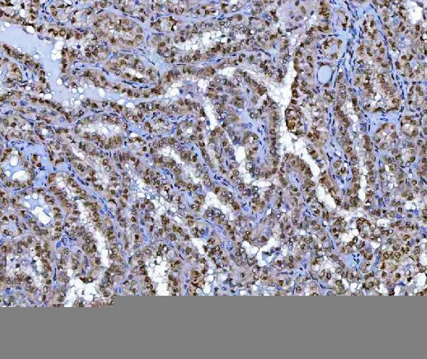a01485 2 bcl11b primary antibodies ihc testing 8