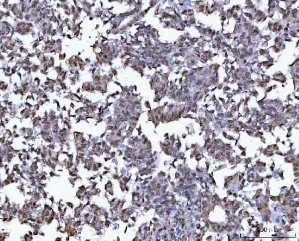 a01485 2 bcl11b primary antibodies ihc testing 9