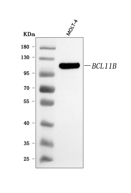  Western blot analysis of BCL11B using anti-BCL11B antibody (A01485-2)