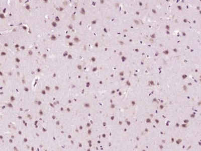 a01485 bcl11b primary antiboties ihc testing 1