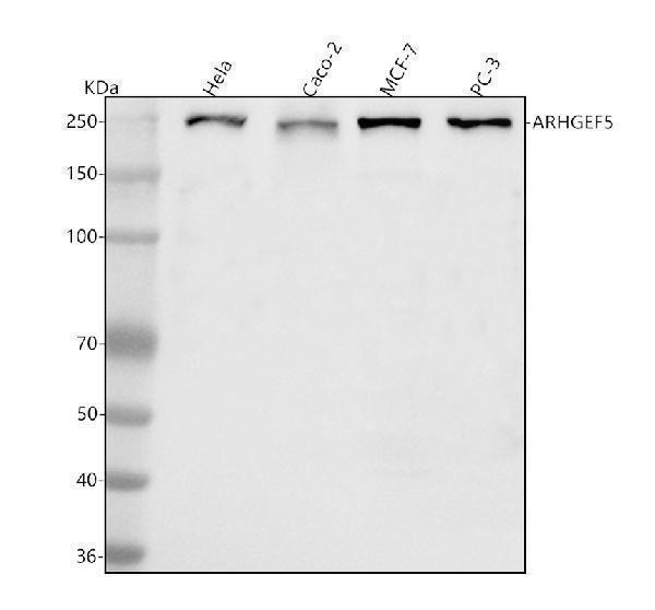  Western blot analysis of ARHGEF5 using anti-ARHGEF5 antibody (A01487-2)