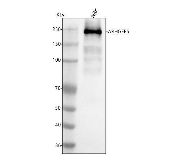  Western blot analysis of ARHGEF5 using anti-ARHGEF5 antibody (A01487-2)
