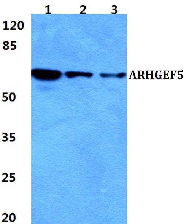 Western blot (WB) analysis of ARHGEF5 polyclonal antibody at 1:500 dilution
Lane1:HEK293T cell lysate
Lane2:sp2/0 cell lysate
Lane3:H9C2 cell lysate