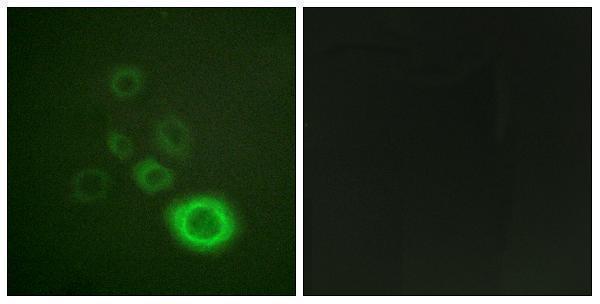 Immunofluorescence analysis of HepG2 cells, using c-Met (Phospho-Tyr1003) Antibody