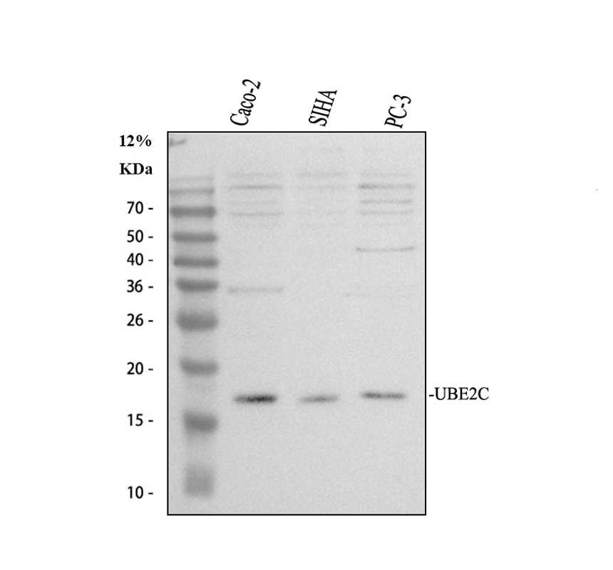 Western blot analysis of UBE2C using anti-UBE2C antibody (A01491-1)