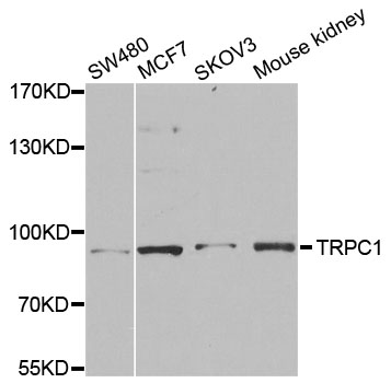 a01492 trpc1 primary antiboties wb testing 1
