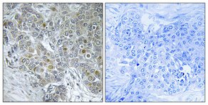 a01493 cdk8 primary antibodies ihc testing 1