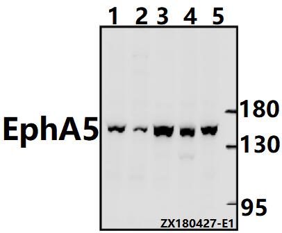 Western blot (WB) analysis of EphA5 (Y515) pAb at 1:500 dilution
Lane1:HCT116 whole cell lysate(40ug)
Lane2:U-87MG whole cell lysate(40ug)
Lane3:SGC7901 whole cell lysate(40ug)
Lane4:HEK293T whole cell lysate(40ug)
Lane5:K562 whole cell lysate(40ug)