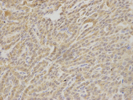 a01495 1 hax1 primary antiboties if testing 2