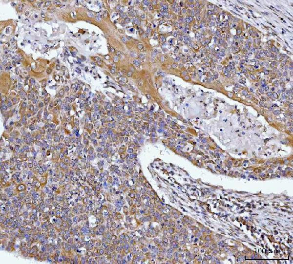 a01495 2 hax1 primary antibodies ihc testing 2