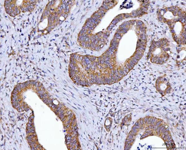 a01495 2 hax1 primary antibodies ihc testing 3