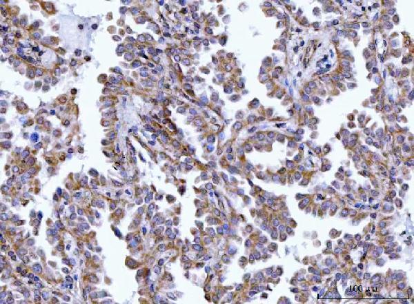 a01495 2 hax1 primary antibodies ihc testing 4
