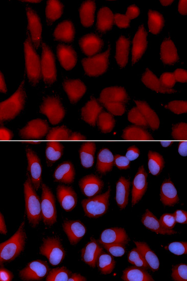 Immunofluorescence analysis of C6 cells using TAP2 Rabbit pAb  at dilution of 1:100 