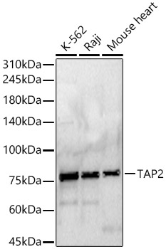 Western blot analysis of various lysates, using TAP2 antibody  at 1:400 dilution