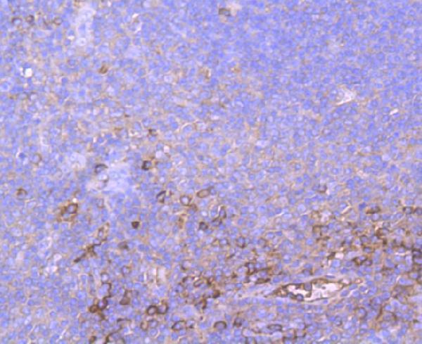a01498 1 a2m primary antiboties ihc testing 2