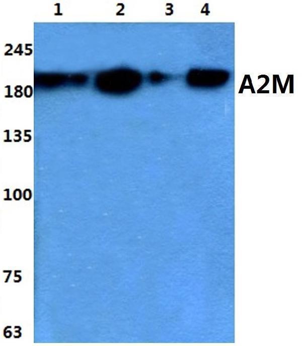 Western blot (WB) analysis of A2M polyclonal antibody at 1:500 dilution
Lane1:HEK293T whole cell lysate
Lane2:Raw264