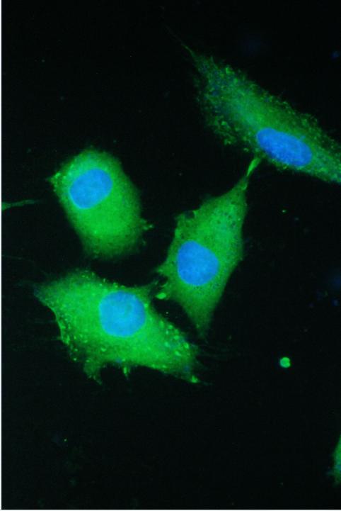 a01501 2 parn primary antibodies if testing 5