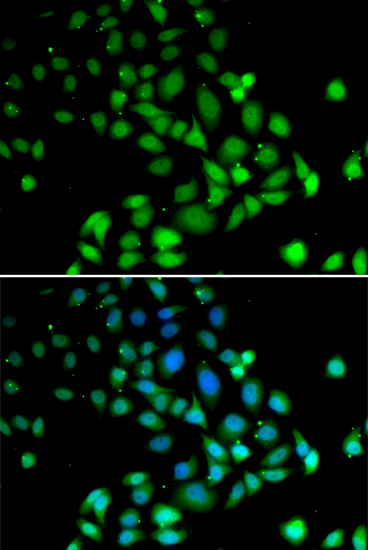 Immunofluorescence analysis of U2OS cells using PARN antibody 