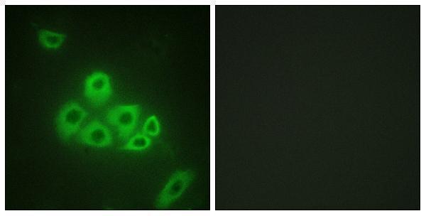 a01502 1 s1pr1 primary antibodies if testing 1