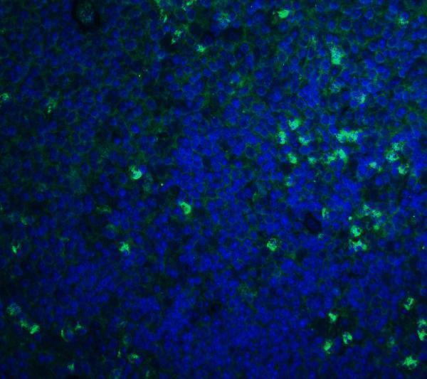 a01502 s1pr1 primary antibodies if testing 4