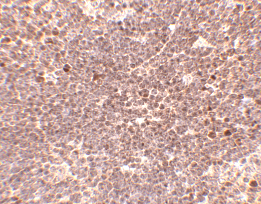 Immunohistochemistry of S1P1 in mouse thymus tissue with S1P1 antibody at 5 μg/mL