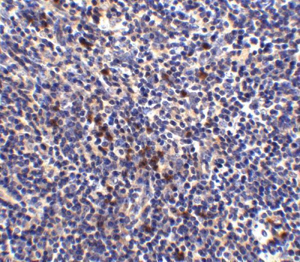 Immunohistochemistry of S1P1 in mouse thymus tissue with S1P1 antibody at 2